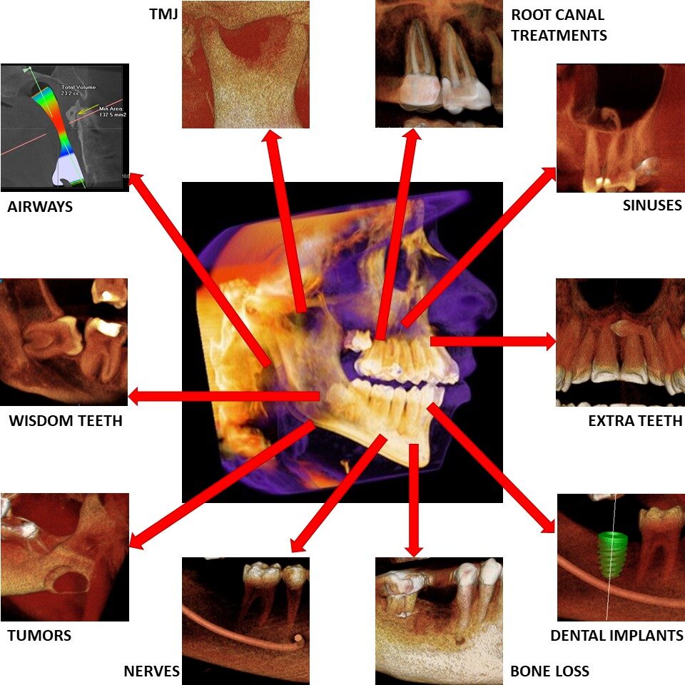3D CT Scanning, areas of concern 